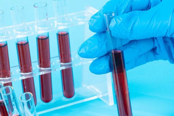 dna親子鑒定費用